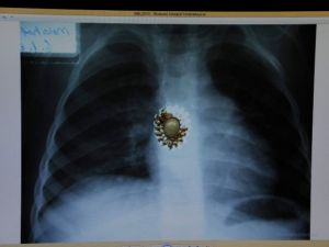 36 yıllık doktorun ilginç koleksiyonu