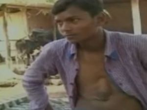 Ölümle burun buruna yaşıyor