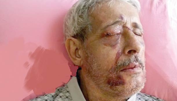 Trabzon'da ilginç olay... Onu bu hale ne getirdi şok olacaksınız