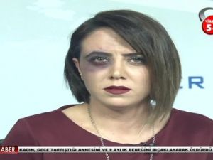 Canlı yayına morarmış gözle çıktı