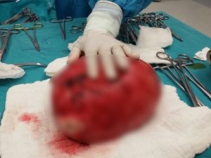 Rahminden 6.5 KG ’lık ur çıktı