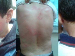 Komşuları rahatsız etti diye çocuğunu darp etti