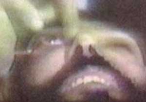 Gözleri asitle kör edilecek