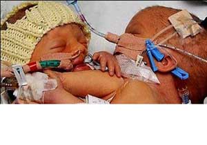 Tek bedende iki yaşam!