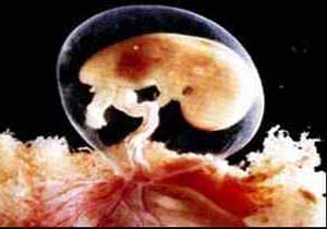 Malatya’da çöplükte cenin bulundu - Malatya Haber