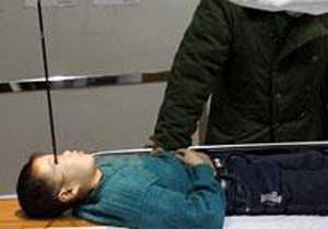 Çocuğun gözüne ok saplandı