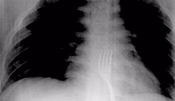 Röntgende şok eden görüntü