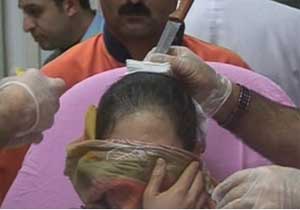 Kafasına bıçak saplandı