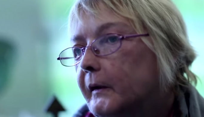 İlk yüz nakli yapılan kişi öldü