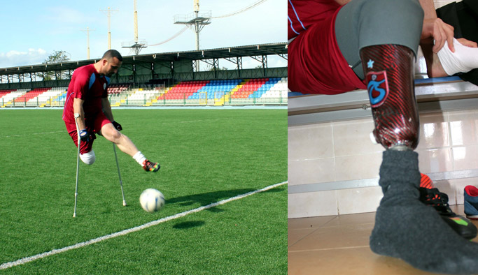 Trabzonlu gazi ampute futbolla engelleri kaldırdı