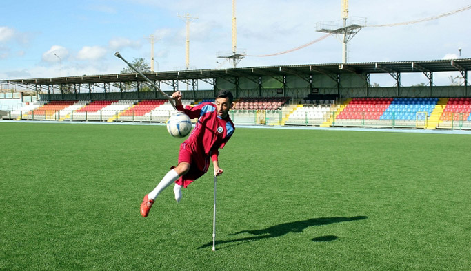 Protezini defalarca kırdı ama futboldan vazgeçmedi