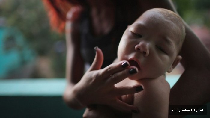 Zika virüsü için "küresel acil durum" kaldırıldı