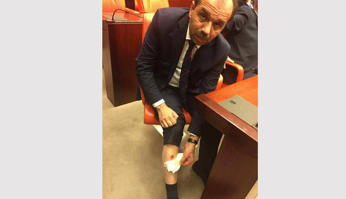 AK Parti Trabzon Milletvekili Mecliste Bacağından ısırıldı!