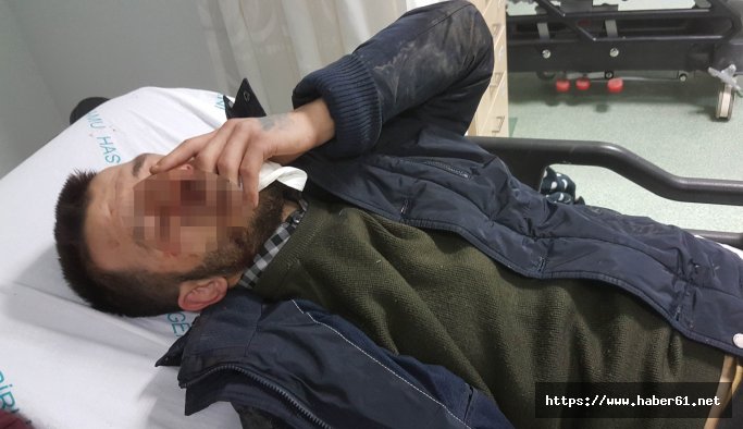 Asker eğlencesinde hastanelik oldu