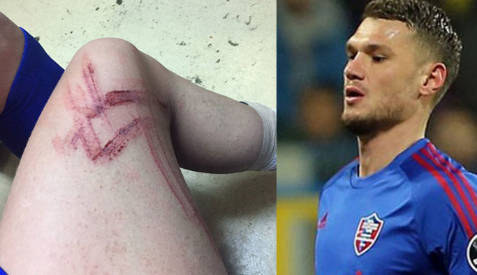 Yusuf Erdoğan'dan sonra onu da biçti!