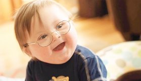 Down sendromu hastalık değil!