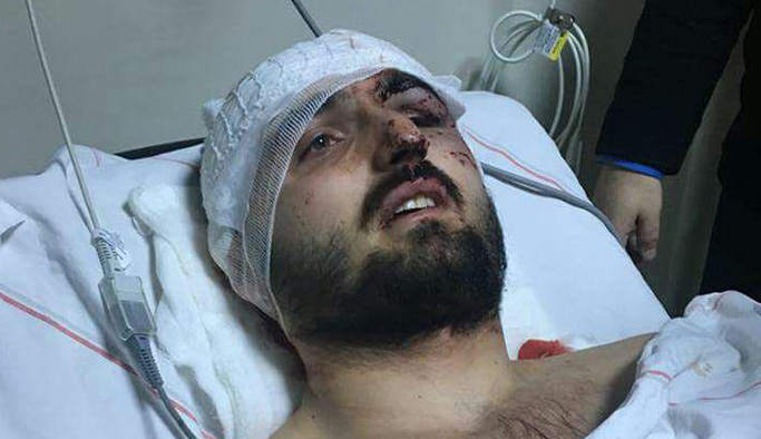 Şampiyonu kuzeni vurmuş!