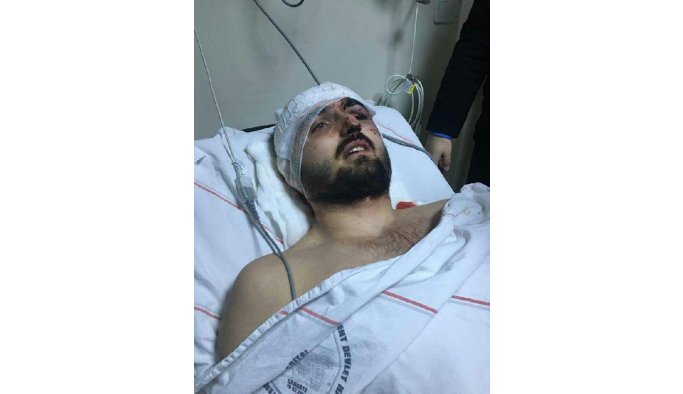 Kuzeni şampiyonu vurdu!