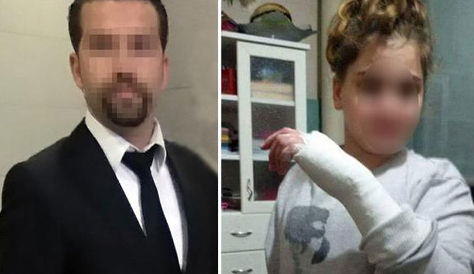 Öğrencisinin elini cetvelle kıran öğretmene 3 bin TL para cezası