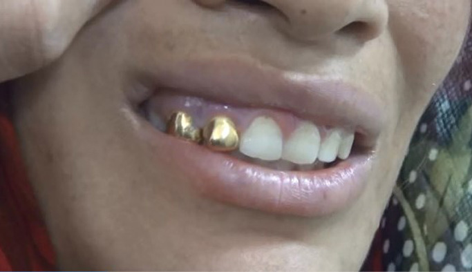 Son model telefonlu, altın dişli dilenciler şaşırttı!