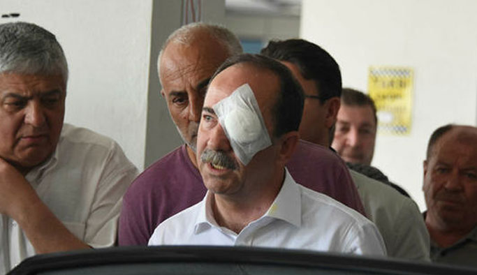 Belediye Başkanına saldıran kişi hakkında karar verildi