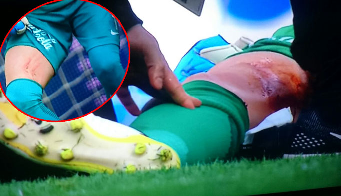 Onur yerde kaldı, herkesi korkuttu!