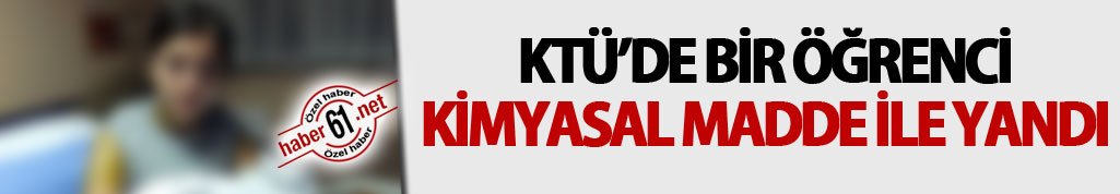 KTÜ’de bir öğrenci kimyevi madde ile yandı