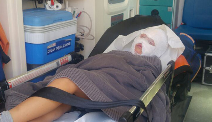 İnternetten bakıp yaptığı patlayıcı çocuğu yaktı