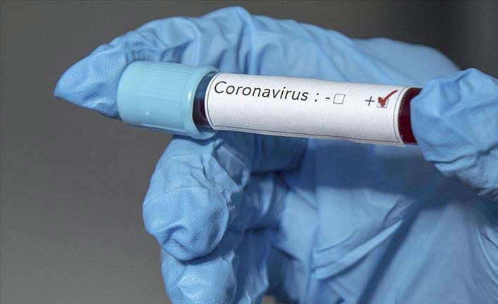 Gana'da Kovid-19 vaka sayısı 29 bine yaklaştı