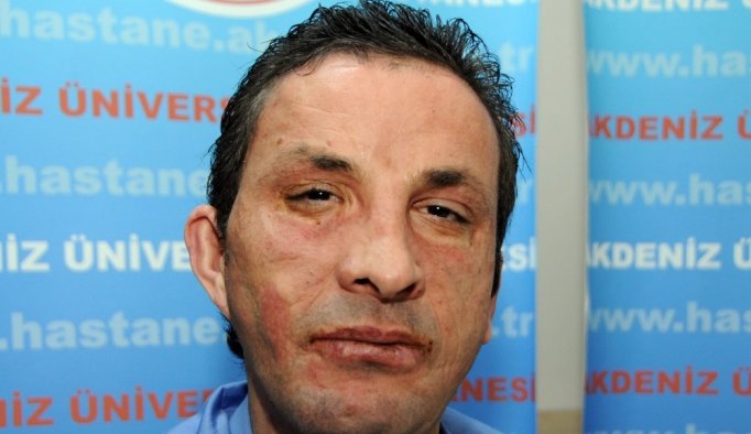 Yüz nakli olmuştu, cinayet davasında karar çıktı