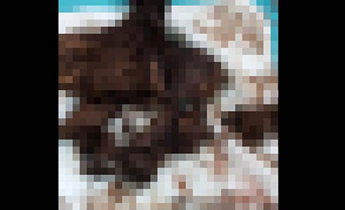 Karın ağrısı şikayetiyle gitti! Midesinden 700 gram...