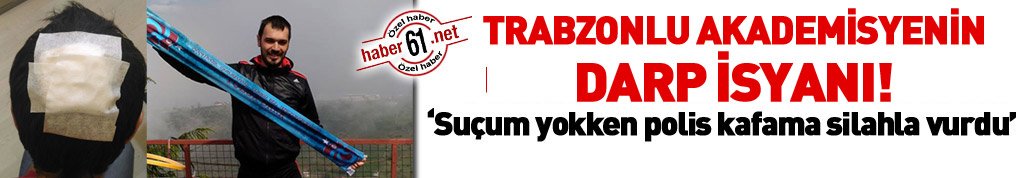 Trabzonlu akademisyenin isyanı: Suçsuz yere darp edildim