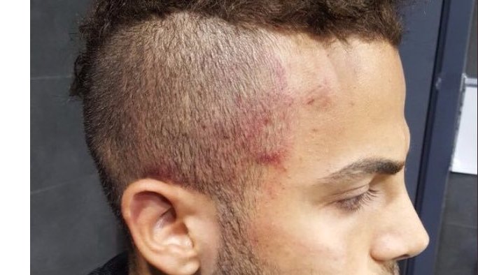 Mertcan Çam'a yapılan saldırıya Trabzon'dan kınama