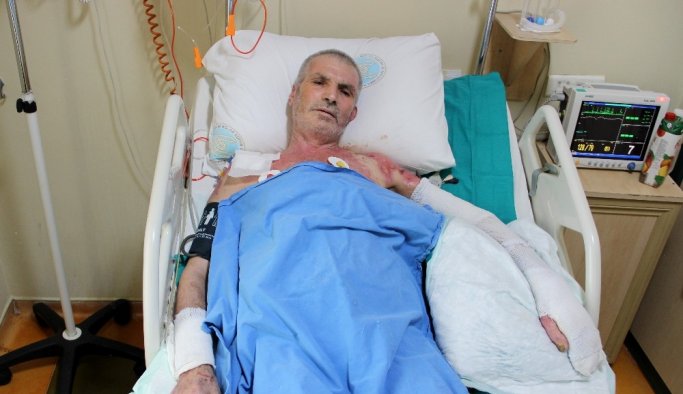 Çatıyı onarmak isterken yüksek gerilime kapıldı!