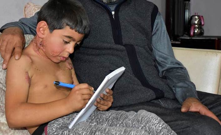 Arkadaşlarından utandığı için okula gidemiyor!