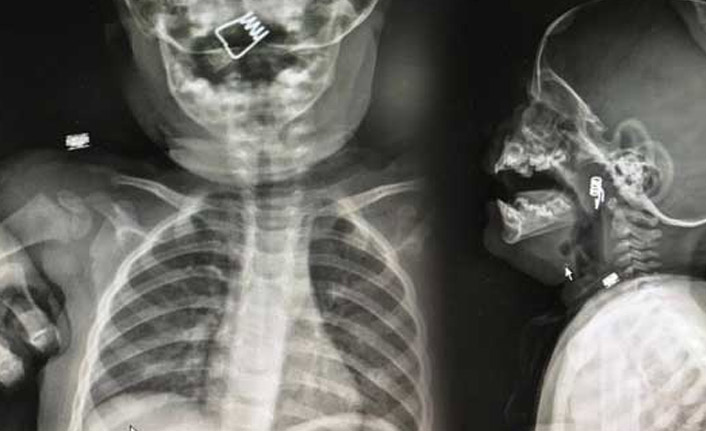 Röntgende çıkanı görünce gözlerine inanamadılar!
