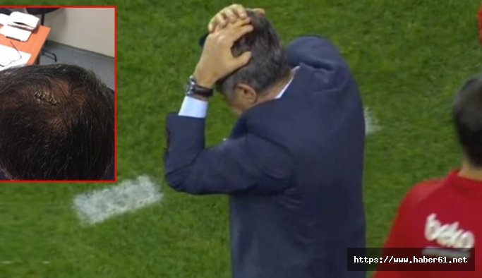 Fenerbahçe'den Şenol Güneş'in yaralandığı maçla ilgili skandal açıklama!