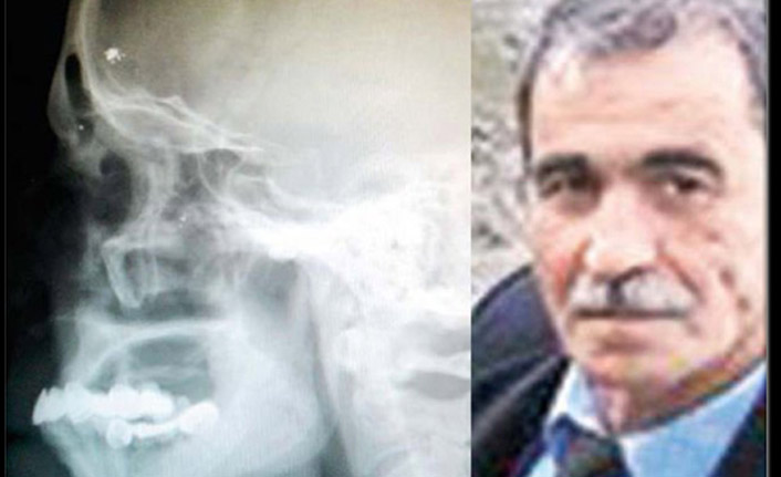 Trabzon'da akıl almaz olay