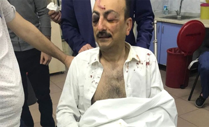 Milletvekili adayını hastanelik ettiler