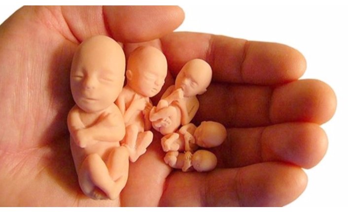 İrlanda'da referandumdan 'kürtaj kalksın' kararı çıktı