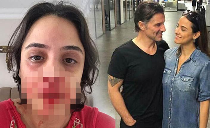 Hazım Körmükçü Nişanlısı Zeynep Tandoğan'ı darp etti - Zeynep Tandoğan kimdir?