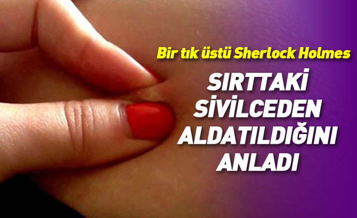 Aldatılan kadından film gibi baskın! Kocasının sırtındaki sivilcelerden olayı çözdü