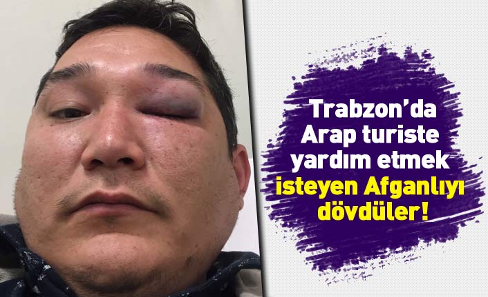 Trabzon'da Arap turiste yardım etmek isteyen Afganlıyı dövdüler