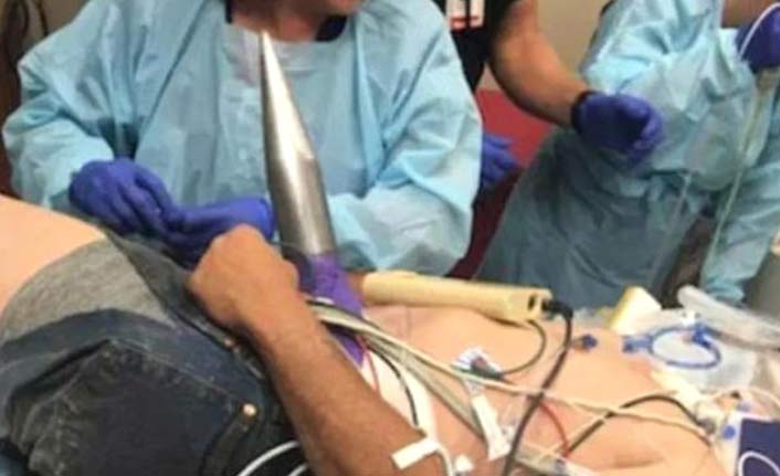 Korkunç! 40 cm'lik metal kazık vücuduna girdi