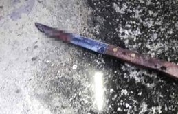 Karısının yanında bastığı adamın cinsel organını kesti!