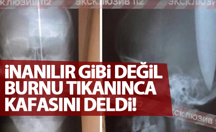 İnanılır gibi değil! Nefes alamayınca kafasını deldi