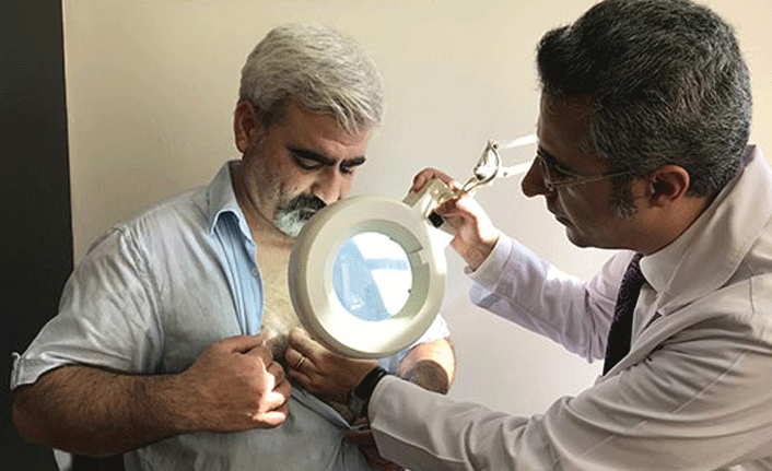 Sivilce sandığı hastalığıyla 12 yıldır mücadele ediyor