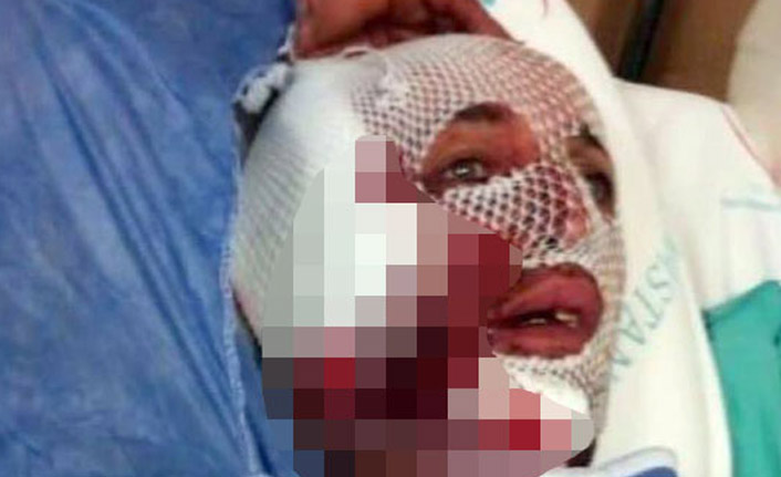 Çalıştığı fabrikada köpeğin saldırısına uğradı