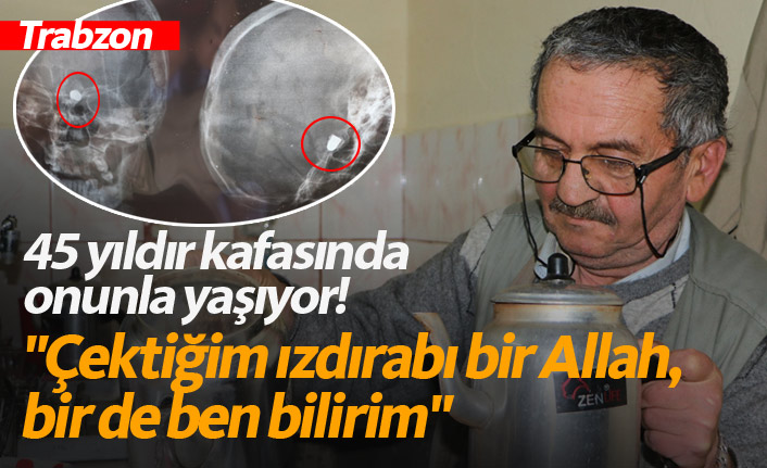45 yıldır kafasında mermiyle yaşıyor!