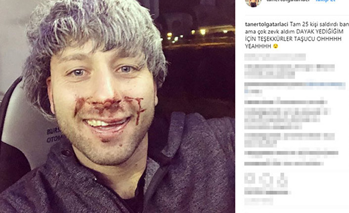 Survivor Taner'i dövdüler "Zevk aldım"